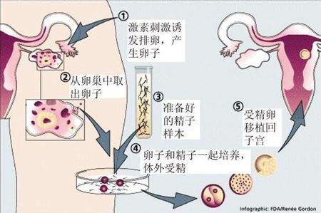 供卵试管选性别代生公司
